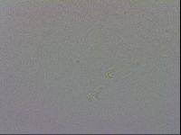 Mesobiotus coronatus image