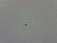 Mesobiotus coronatus image