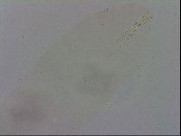 Mesobiotus coronatus image