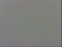 Mesobiotus coronatus image