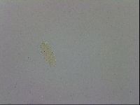 Mesobiotus coronatus image