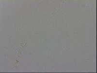 Mesobiotus coronatus image