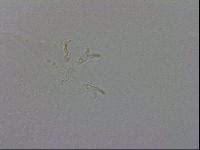 Mesobiotus coronatus image