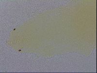 Mesobiotus coronatus image