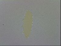 Mesobiotus coronatus image