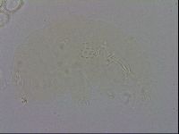 Mesobiotus coronatus image