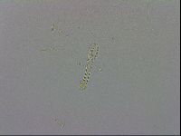Mesobiotus coronatus image