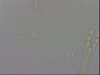 Mesobiotus coronatus image