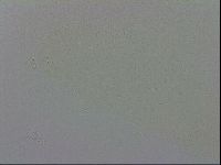 Mesobiotus coronatus image