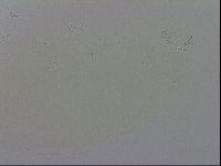 Mesobiotus coronatus image