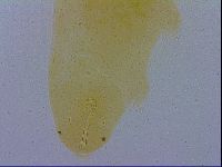 Mesobiotus coronatus image