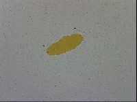 Mesobiotus coronatus image