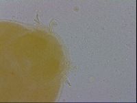 Mesobiotus coronatus image