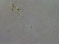 Mesobiotus coronatus image