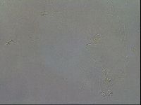 Mesobiotus coronatus image