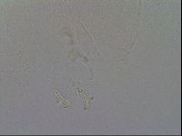 Mesobiotus coronatus image