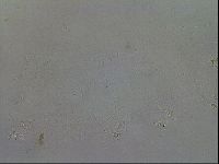 Mesobiotus coronatus image