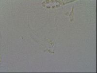 Mesobiotus coronatus image
