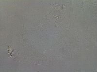 Mesobiotus coronatus image