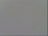 Mesobiotus coronatus image