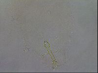 Mesobiotus coronatus image