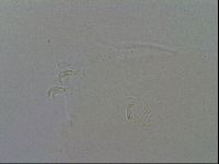 Mesobiotus coronatus image