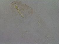 Mesobiotus coronatus image