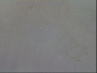 Mesobiotus coronatus image