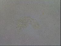 Mesobiotus coronatus image