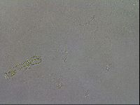 Mesobiotus coronatus image
