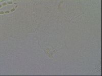 Mesobiotus coronatus image