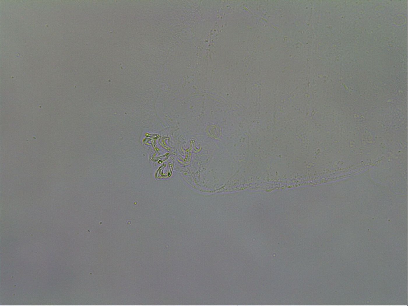 Mesobiotus coronatus image