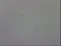 Mesobiotus coronatus image