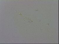Mesobiotus coronatus image