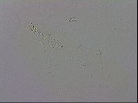 Mesobiotus coronatus image