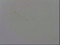 Mesobiotus coronatus image