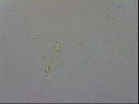 Mesobiotus coronatus image