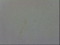 Mesobiotus coronatus image