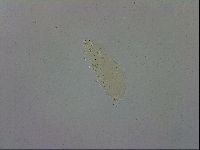 Mesobiotus coronatus image