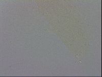 Mesobiotus coronatus image
