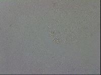 Mesobiotus coronatus image