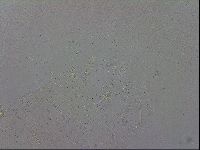 Mesobiotus coronatus image