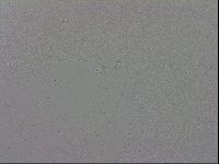 Mesobiotus coronatus image
