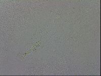 Mesobiotus coronatus image