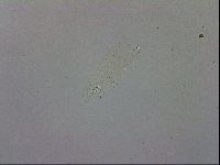 Mesobiotus coronatus image