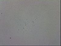 Mesobiotus coronatus image