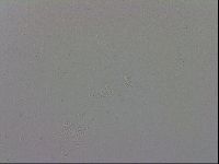 Mesobiotus coronatus image