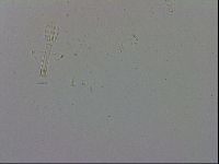 Mesobiotus coronatus image