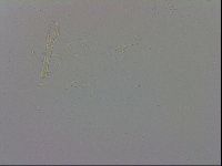 Mesobiotus coronatus image