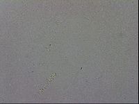 Mesobiotus coronatus image
